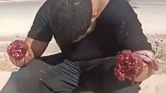 Video of the jordanian young man with his hands cut off Photo 0001 Video Thumb
