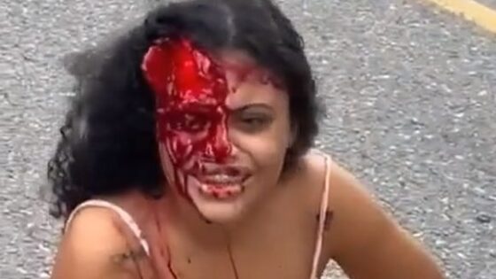 Woman scalped alive in colombia is left completely disfigured and mutilated Photo 0001 Video Thumb