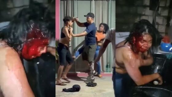 Woman stabbed by lesbian lover during separation process in brazil Photo 0001 Video Thumb