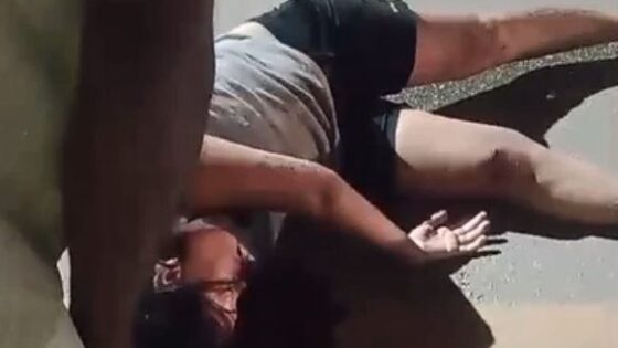 Accident in maragogi al brazil 08302023 the woman suffered head trauma Photo 0001 Video Thumb