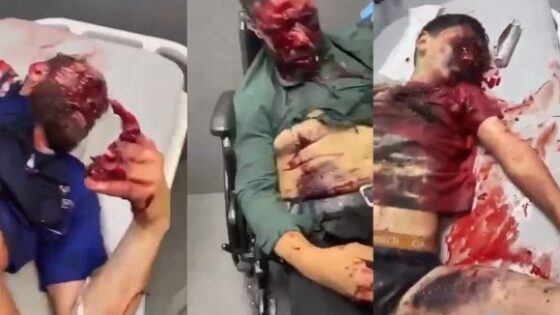 Horrible real footage after the israeli pager bomb attack in beirut lebanon Photo 0001 Video Thumb