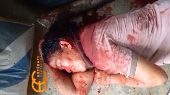 Lunatic attacks his own mother with a machete in colombia Photo 0001 Video Thumb