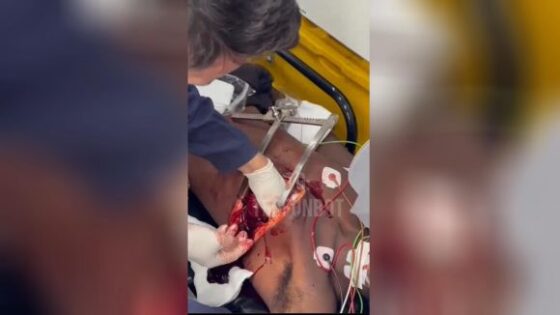 Paramedics suturing a victims heart inside an ambulance during an emergency in brazil Photo 0001 Video Thumb