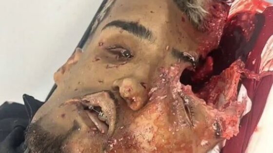 Three drug dealers are executed aftermath only Photo 0001 Video Thumb