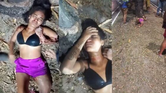 Traffic accident involving bicycles leaves women with mutilated legs in brazil Photo 0001 Video Thumb