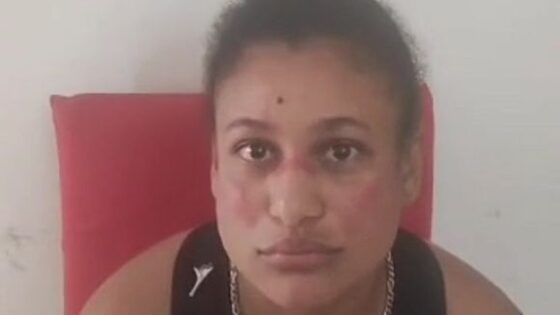 Woman punished by blows to her genitals with flip flops in brazil for reasons involving her lover Photo 0001 Video Thumb
