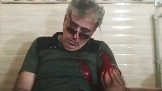 Arab man shoots himself in the head in suicide on live stream on social media Photo 0001 Video Thumb