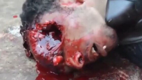 Guy taking his last breath after being shot in the eye in pakistan Photo 0001 Video Thumb