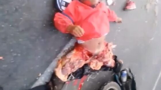 Man crushed by truck has his body destroyed in traffic accident better to have died Photo 0001 Video Thumb