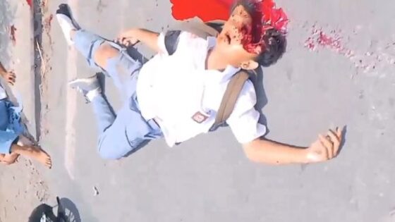 Mans head is split wide open due to accident Photo 0001 Video Thumb