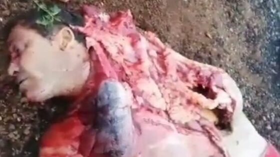 Traffic accident leaves human being with his body open in a pile of flesh Photo 0001 Video Thumb