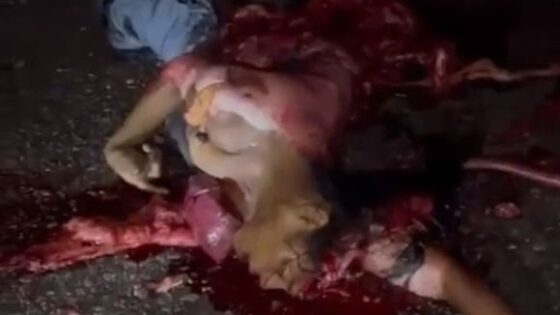 Woman completely destroyed and crushed on the asphalt after being run over by a truck in brazil Photo 0001 Video Thumb