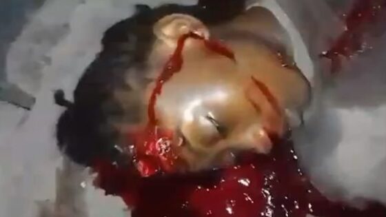 Young haitian woman shot in the head in a pool of blood Photo 0001 Video Thumb
