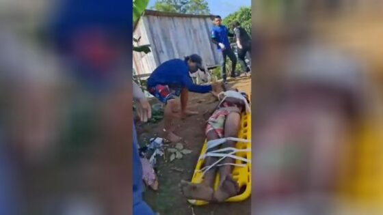 Man found beaten cut and stabbed on stretcher during rescue operation is attacked and stabbed again in horrific murder attempt in brazil Photo 0001 Video Thumb