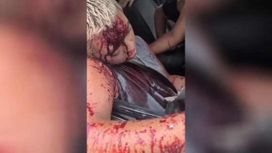 Terrible traffic accident in brazil leaves two people dead and the cars occupants in a state of shock Photo 0001 Video Thumb