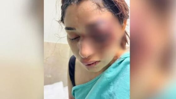 Tramp attacks girlfriend outside nightclub and leaves her mutilated Photo 0001 Video Thumb