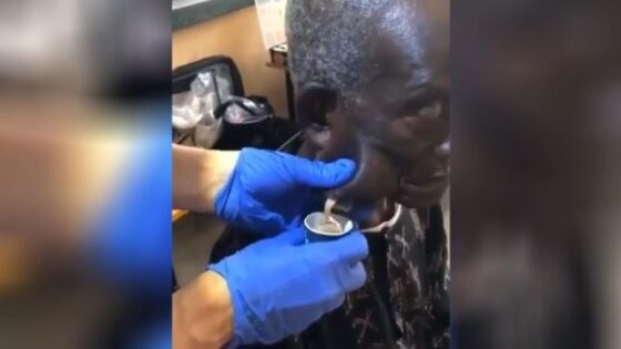 A man has a cyst right on his cheek Photo 0001 Video Thumb