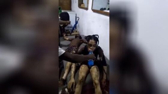 Burned people in haiti try to relieve themselves with ice water Photo 0001 Video Thumb