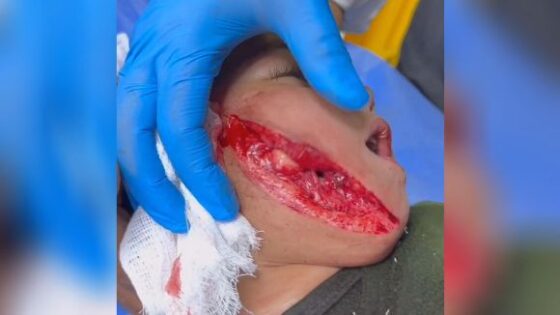 Child hit by sharp object now fights to survive but will have terrible consequences i hope the doctors do a good job Photo 0001 Video Thumb