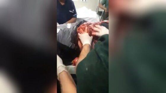 Man attacked by lion and bengal tiger aftermath Photo 0001 Video Thumb