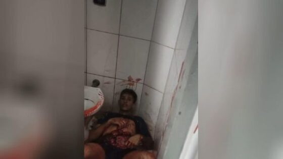 Organs exposed in bathroom Photo 0001 Video Thumb