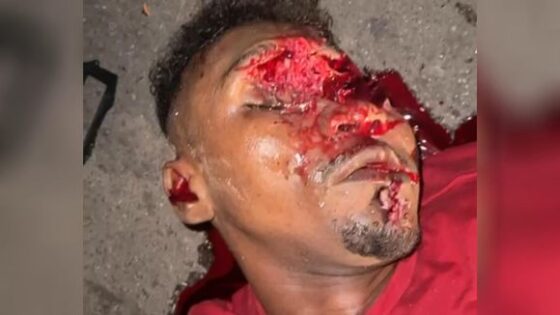 Traffic accident in brazil leaves man with his face completely crushed while woman films and points out his misfortune Photo 0001 Video Thumb