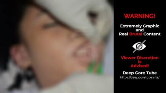 18 year old woman drug overdose body exam case 03 Photo 0001 Video Thumb