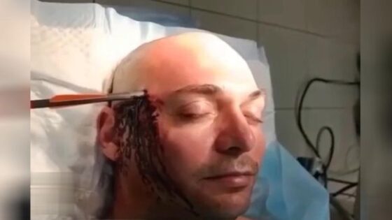 He received an arrow to the head and is still alive Photo 0001 Video Thumb