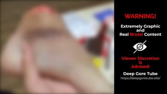 Vietnamese man allegedly with mental problems plays with amputated foot as if it were a toy to play with Photo 0001 Video Thumb