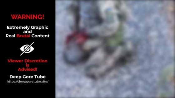 Ukrainian soldier with destroyed hands tries to use a tourniquet but fails in this terrible condition Photo 0001 Video Thumb