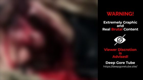 Mans face completely destroyed and deformed Photo 0001 Video Thumb