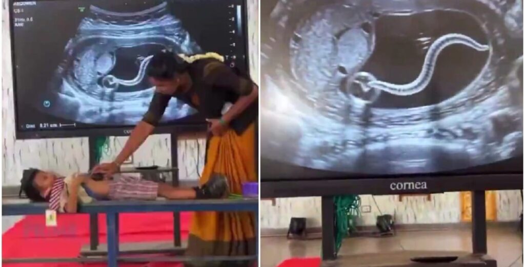 Teacher demonstrates a fake ultrasound-style scan to children during a junk-food lesson.